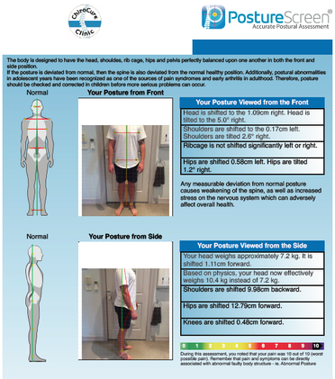 Posture screen chirocure chiropractic