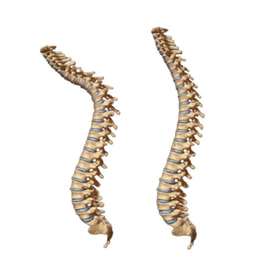spinal curve correction